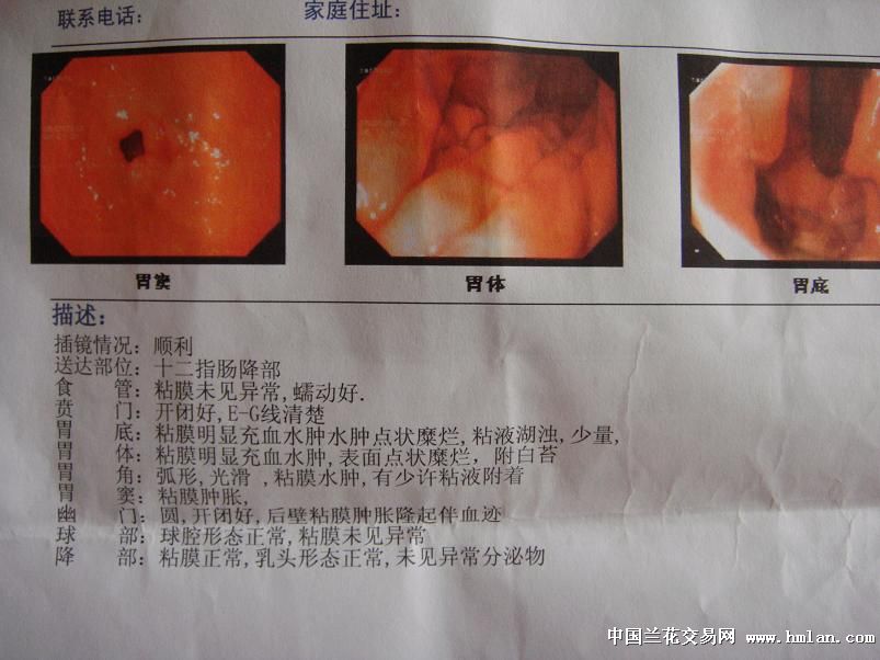 懂医学的请进